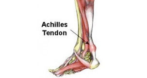 Achilles Pain | Achilles Tendon Injuries