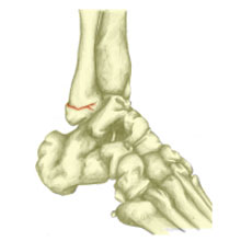 Have I Broken My Ankle? - Ankle Fracture Explained