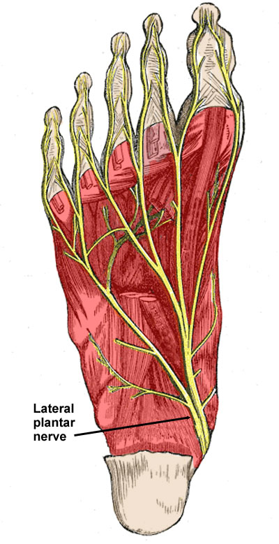 Nervio Plantar Lateral