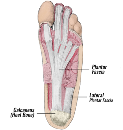 lateral plantar fascia foot pain