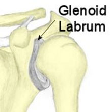 Glenoid Labrum Tear - Symptoms, Causes, Treatment and Rehabilitation