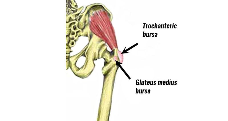 Physical Therapy for Hip Bursitis - Professional Rehabilitation Services