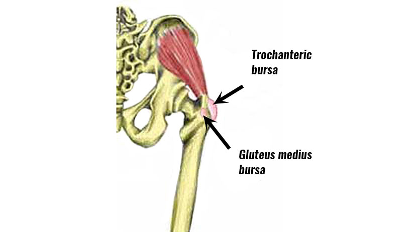 Chronic Groin Pain – More Than Just Osteitis Pubis - Newcastle