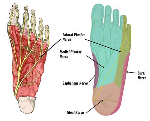 heel pain nerve entrapment