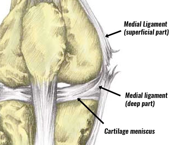 Medial Knee Ligament Mcl Sprain Symptoms Treatment