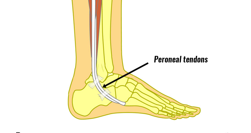 Ankle Injuries Dislocation Impingement Sprain Fracture Peroneal Tendon ...