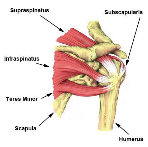 bilateral rotator cuff tendonitis