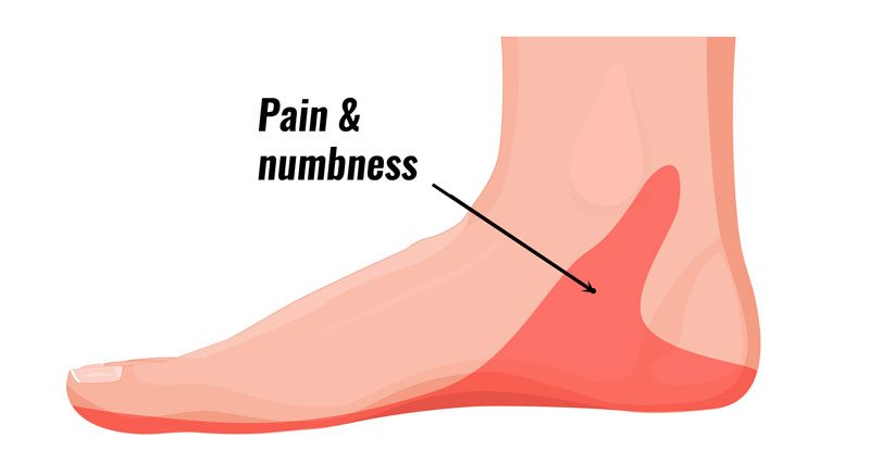 inside heel pain