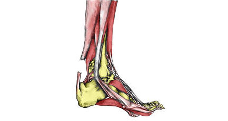 pulled tendon in heel