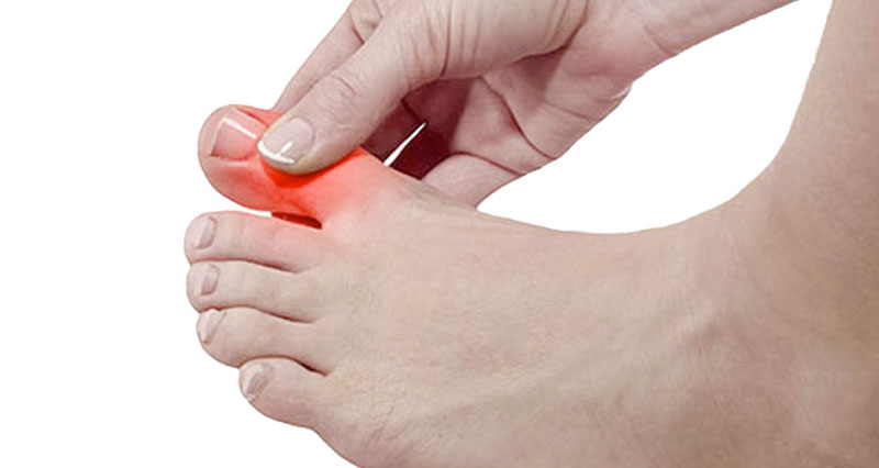 Toe Pain - Symptoms, Causes and Treatment