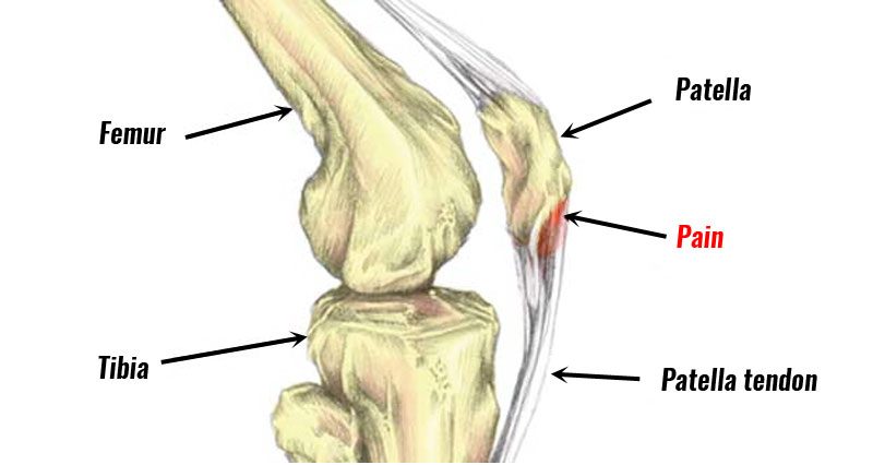 pain below knee cap on bone