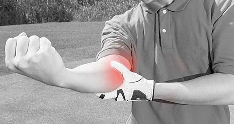 Medial Elbow Ligament Sprain - Symptoms, Causes, Treatment & Rehab