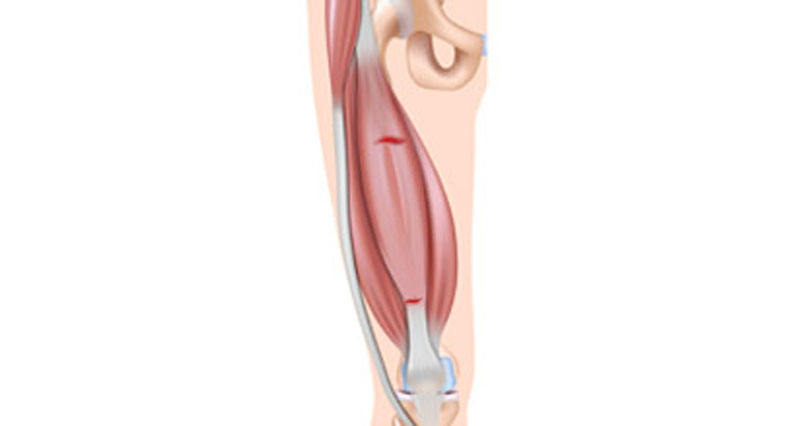 anterior upper leg muscles