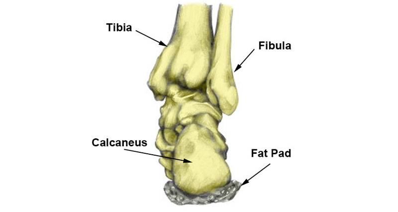 foot pad syndrome