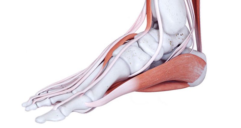 muscle pain in sole of foot