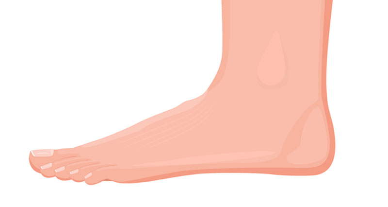 pain outside heel below ankle