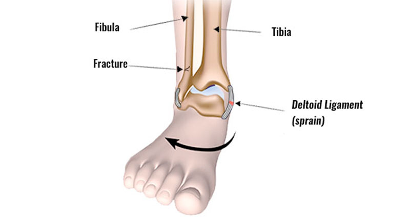 deltoid ligament of the ankle