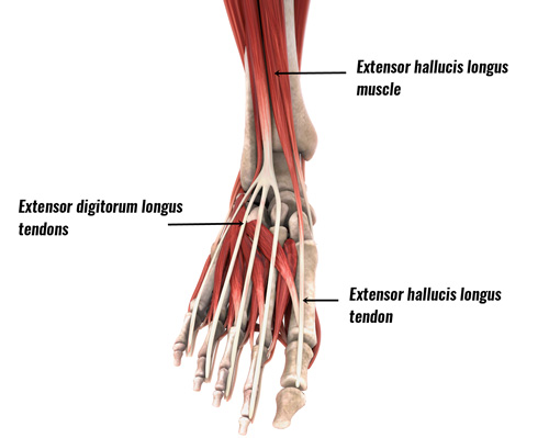 Extensor tendonitis - extensor muscles and tendons of the foot