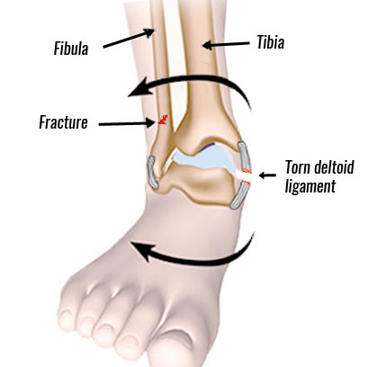 medial ankle ligaments and tendons