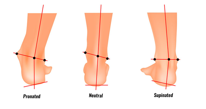 Supination (Foot Biomechanics 