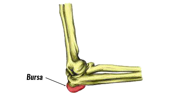 Medial collateral ligament injury elbow