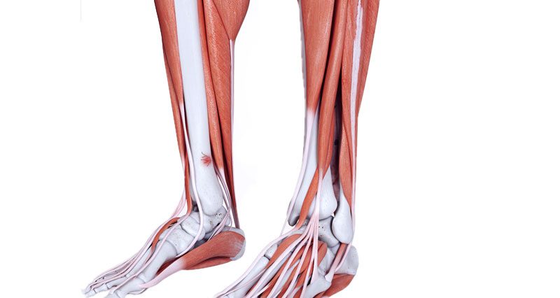 medial tibial stress fracture