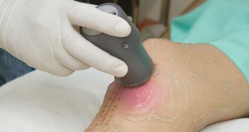 Ultrasound Therapy for Pain: Benefits, Procedure, Risks